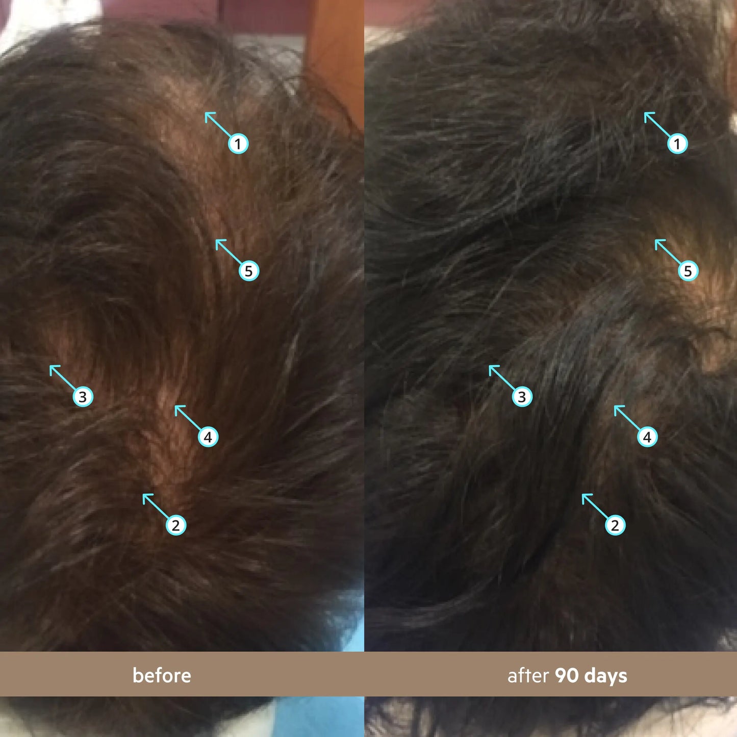 Spectral Men's (Spectral.DNC-N) | Hair Density Serum with Nanoxidil 5%